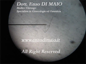 Candida albicans - Dott. Enzo DI MAIO - ITALY